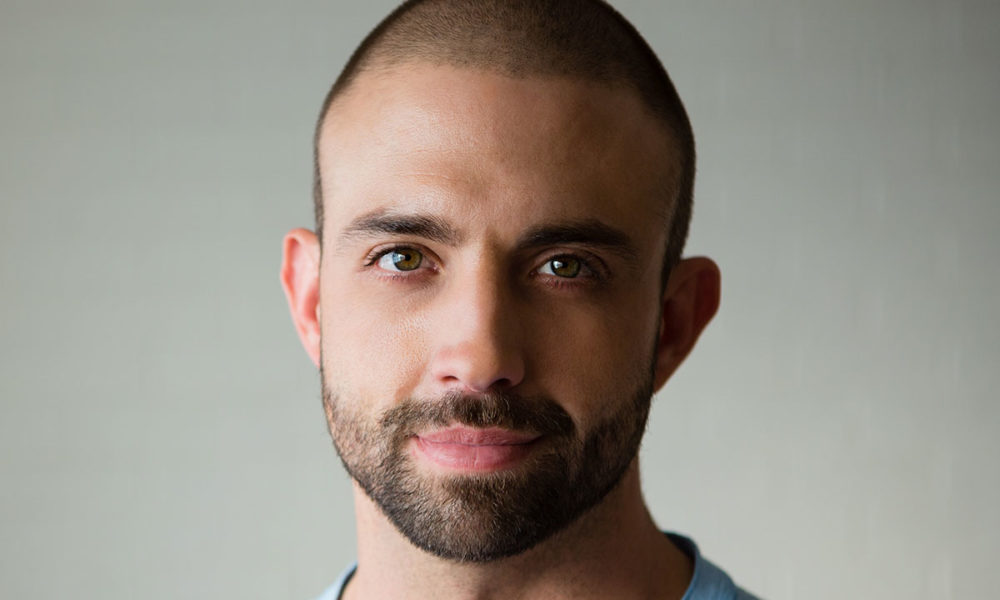 micro pigmentation pour masquer calvitie paris bruxelles annecy lyon montbeliard