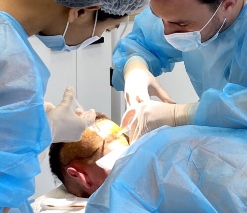 greffe capillaire rue bruxelles