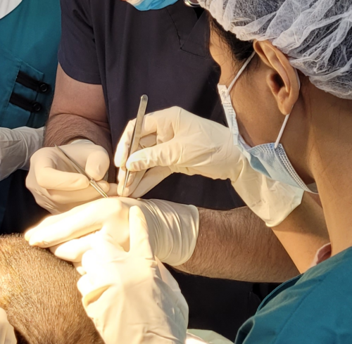 greffe de cheveux fue mougins